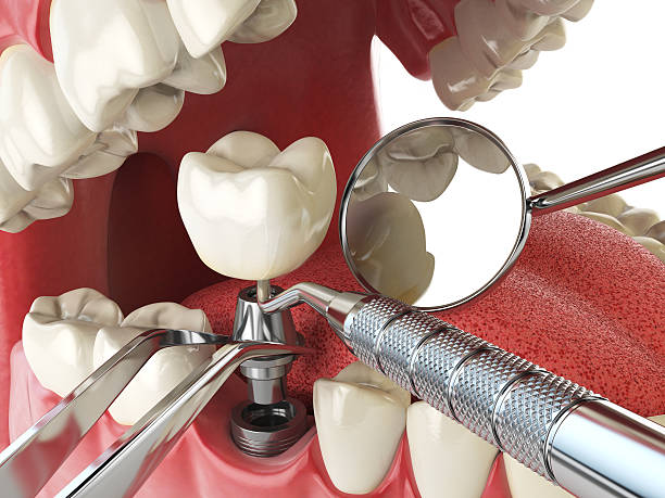 Best Emergency Treatment for Toothache in Pawnee, IL